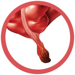 appendix_organ_packaging
