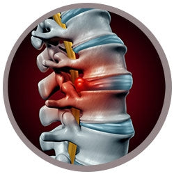 Back Pain Plush promotional image